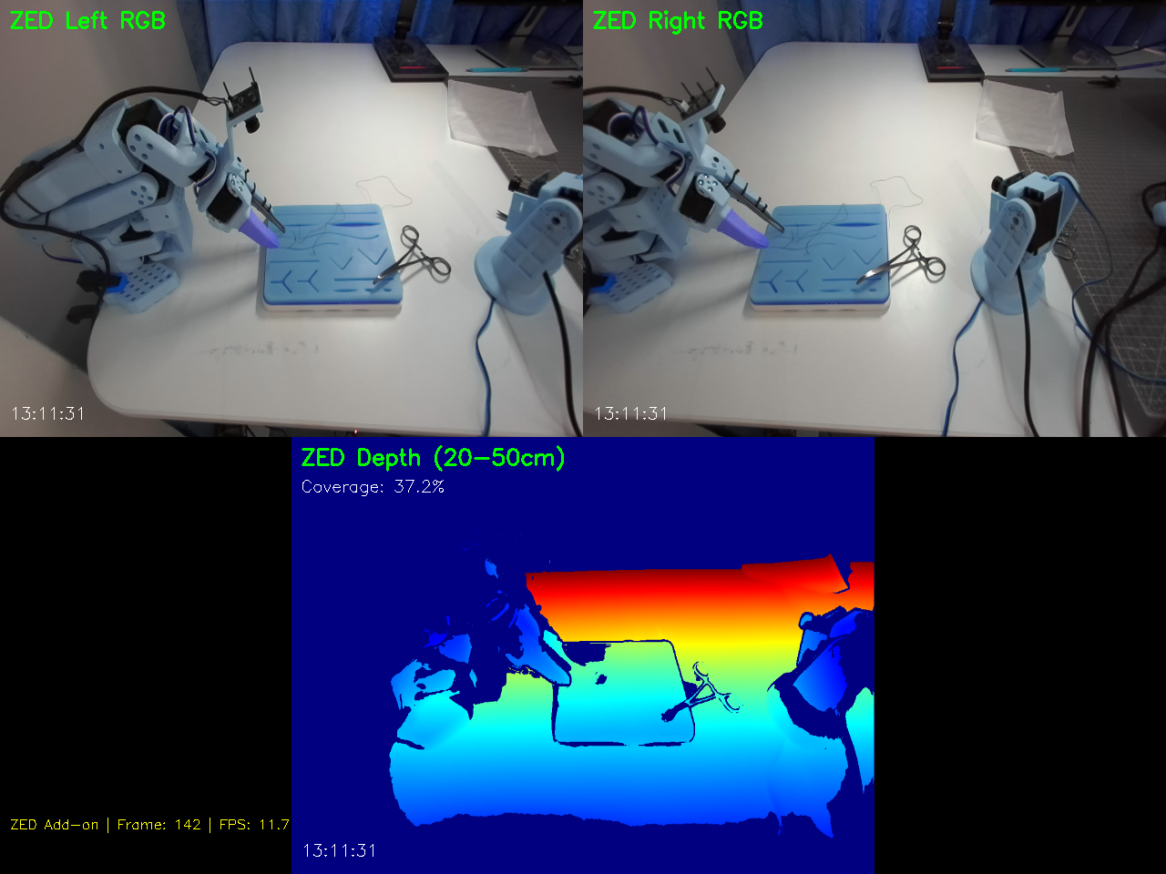 ZED Surgical Cameras